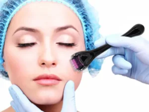 Derma Roller 0.5mm for Hair & Skin Therapy | 540 Titanium Micro-Needles